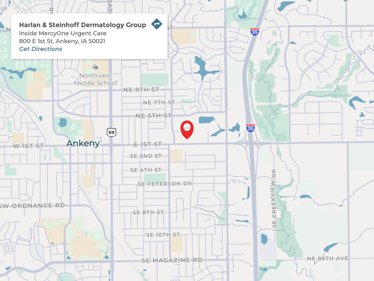 Ankeny_HarlanMap2