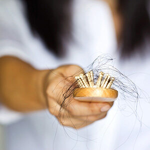 Dermatology Services Hair Loss