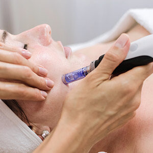 Microneedling