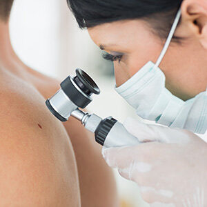 Dermatology Services Skin Cancer